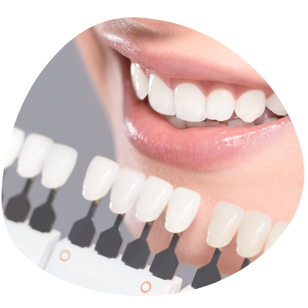 teeth whitening las vegas