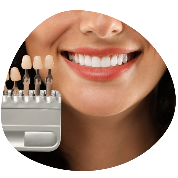 dental shade guide dental shade guide