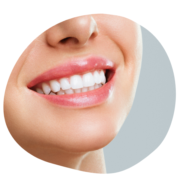 bright white smile