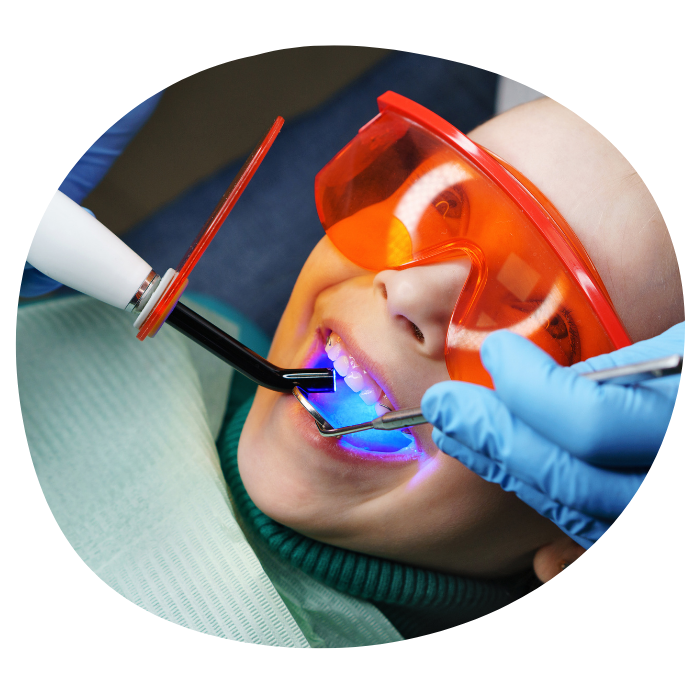 Smiling child with dental curing light Child with glasses receiving dental fillings