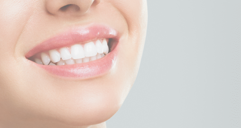 Teeth Whitening Las Vegas